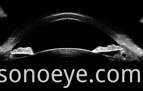 image for Ophthalmic A/B Scanner